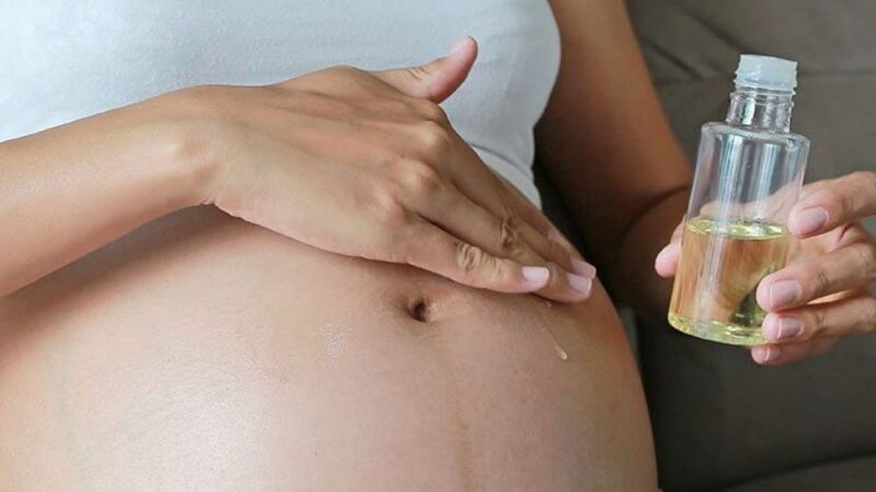 How to Prevent and Treat Stretch Marks Before, During, and After Pregnancy